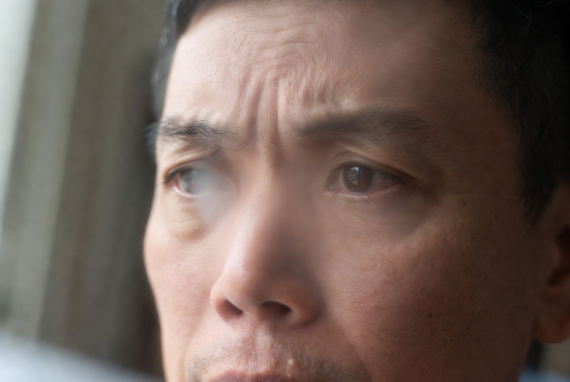 男人眼睛視線模糊-示意圖